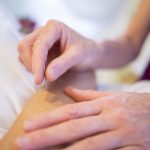 Acupuncture- An Ancient Healing Method